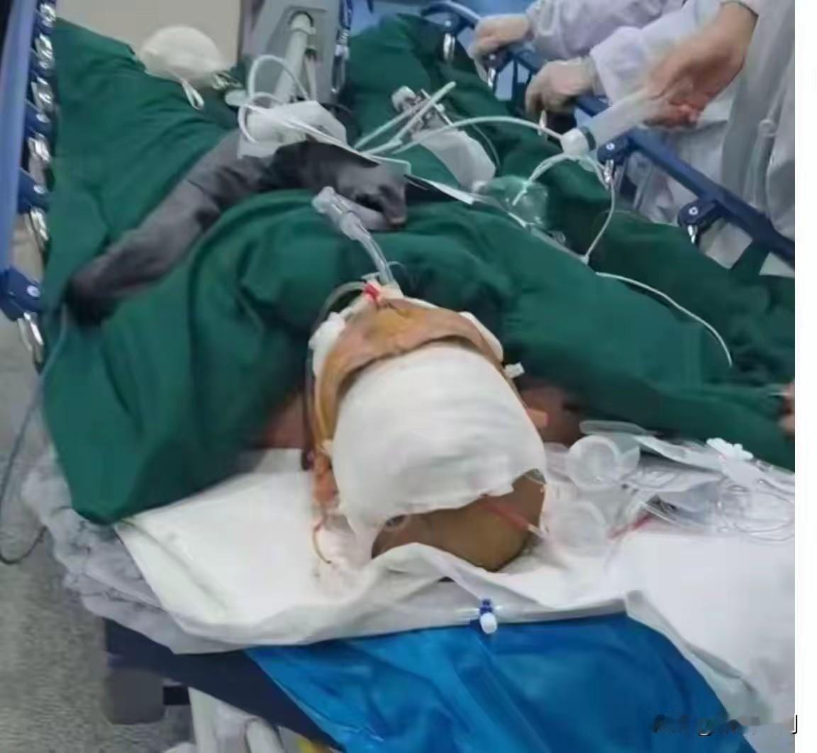 湖北十堰郧西县，一场原本平常的公司聚餐，却因一场严重安全事故，沦为令人痛心疾首的