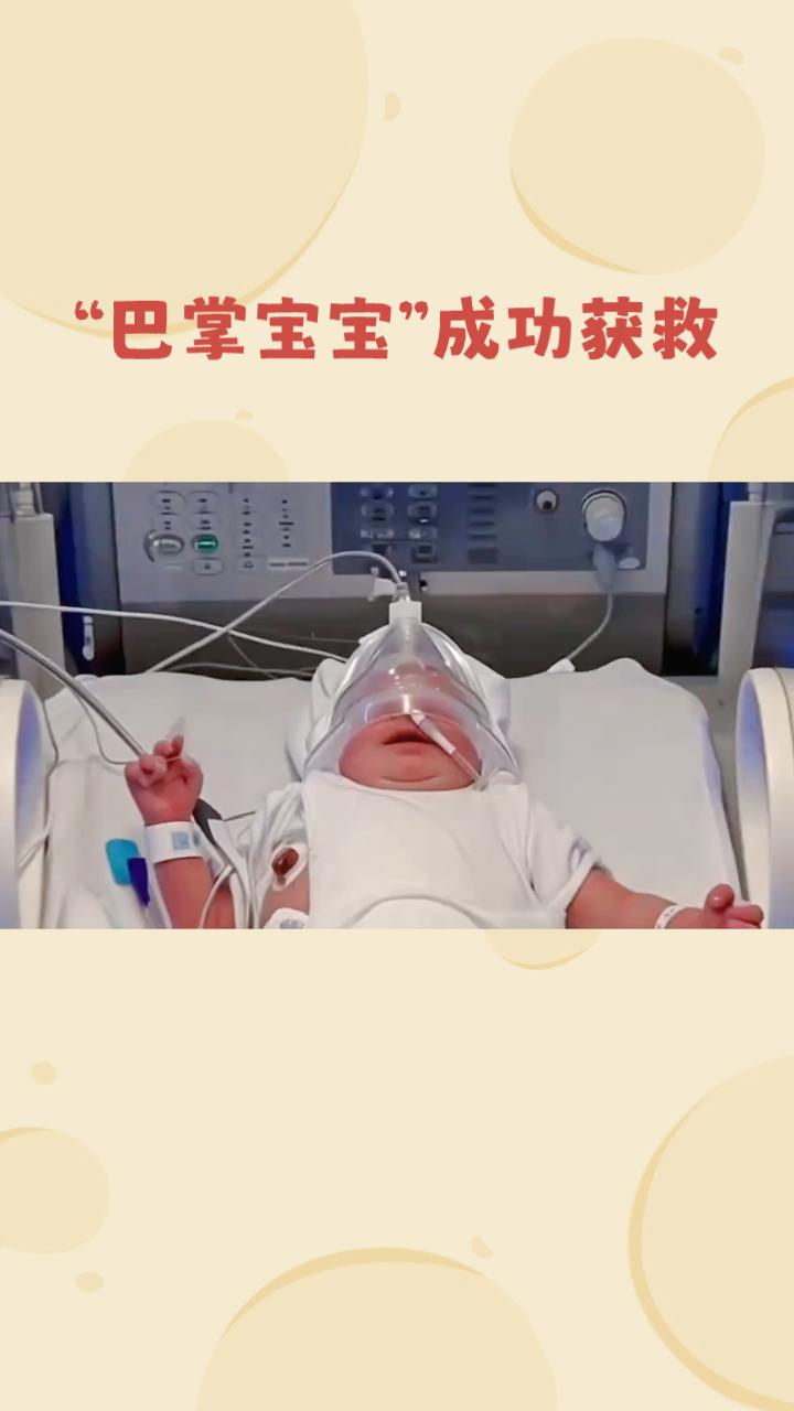 巴掌大的婴儿，如何挑战生命极限？近日，医学界再次见证了生命的奇迹。一名胎龄仅2