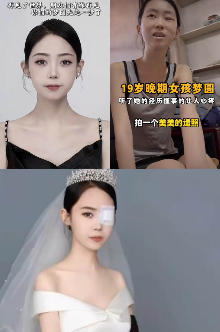 19岁患鼻咽癌的临沂姑娘“梦圆”于8月14日早上离世了，15岁检查出癌症，母亲患