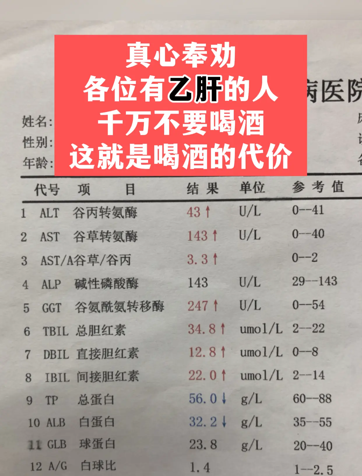 48岁的刘先生来检查，肝功能指标全是异常，知道自己有乙肝还喝酒，白蛋白...
