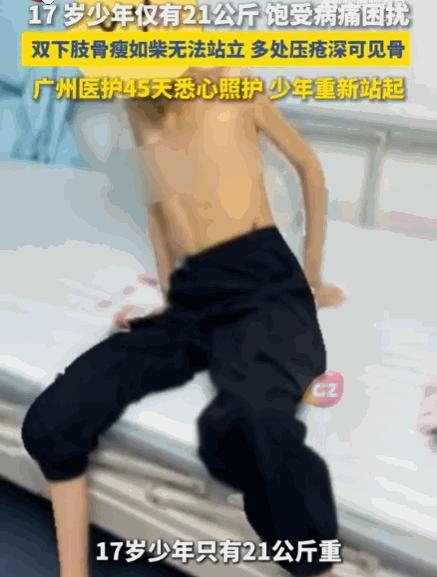悲剧还是发生了！江西，一17岁少年，六年来反复呕吐、无法进食，身高150厘米的他
