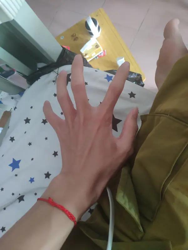 脑梗导致右手右腿无力能不能恢复，这得看具体情况。一般来说，要是脑梗症状轻，治疗又