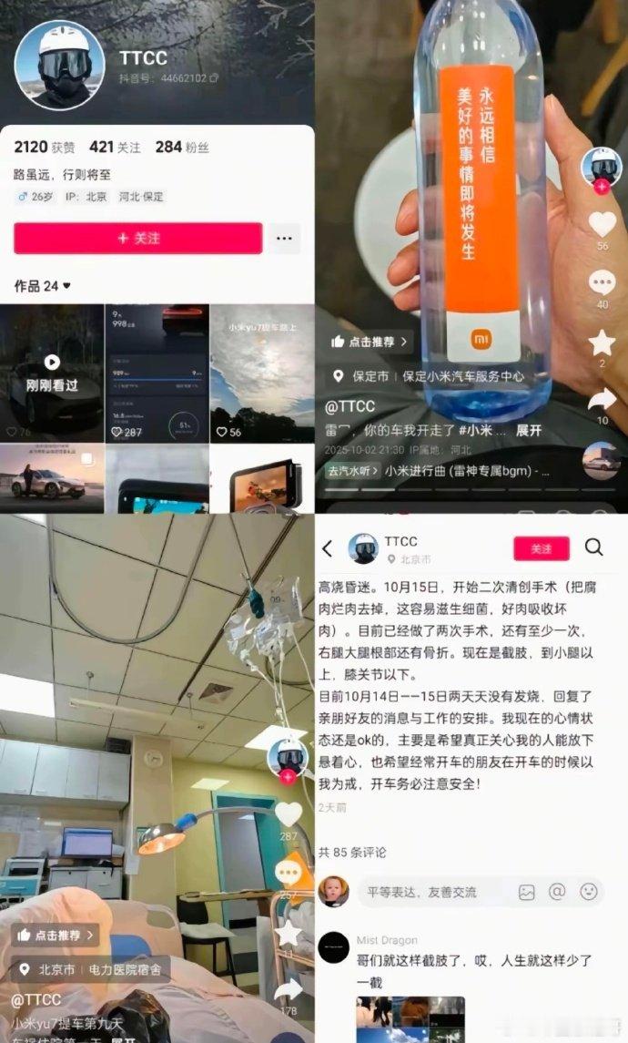 大v聊车可怜的司机什么车才能配的上你？可惜了，小伙子，号也没了，一截腿也没了。