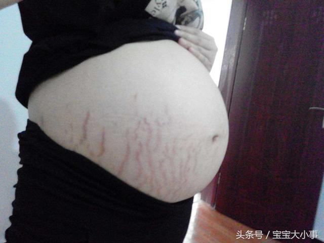 四维排畸遭医生“嫌弃”, 孕妇起身冲出门口, 医生却尴尬无比