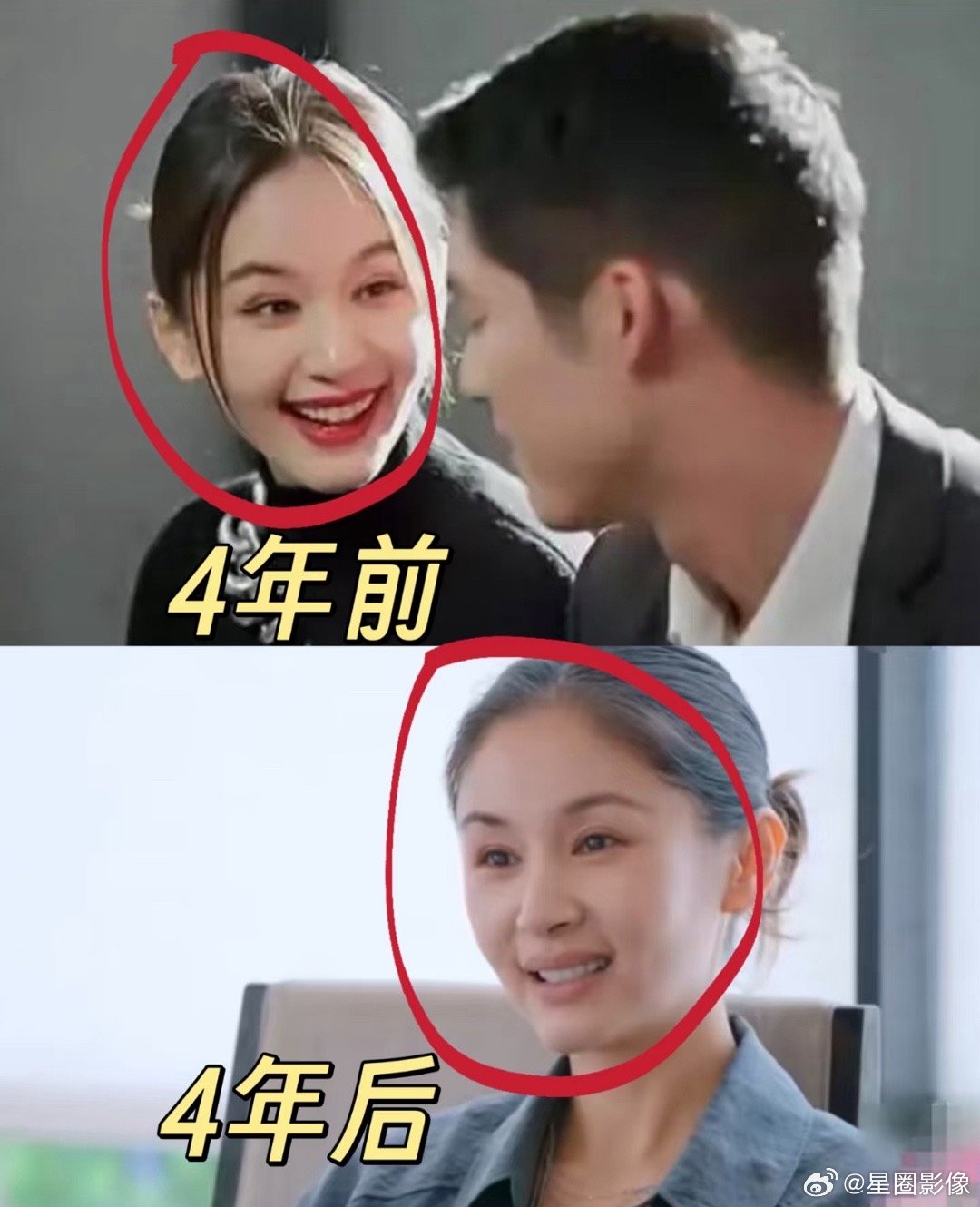 王子文和吴勇恩分手之后好像真的有点老了，王琳节目里两句话直接说出原因​​​