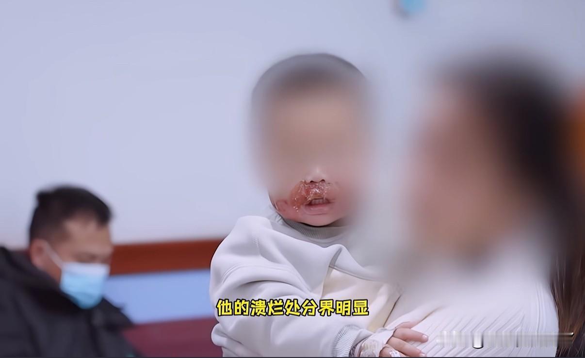 幼童遭亲属虐待，妈妈沉默选择不追究妈妈的沉默才是最让人痛心的，生了孩子却没有能