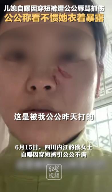 "清官难断家务事！"四川，一儿媳因天气热穿了条白色短裤，竟被50多岁的公公