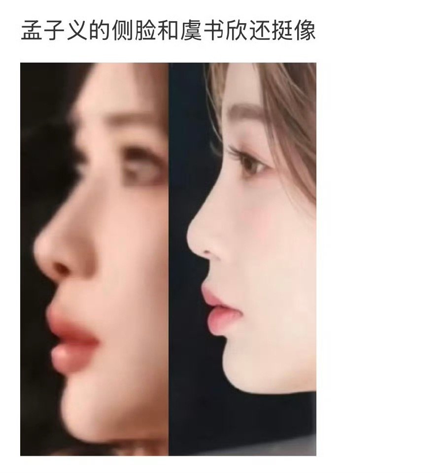 再怎么样孟子义比🐟侧颜好点吧，🐟太虐了