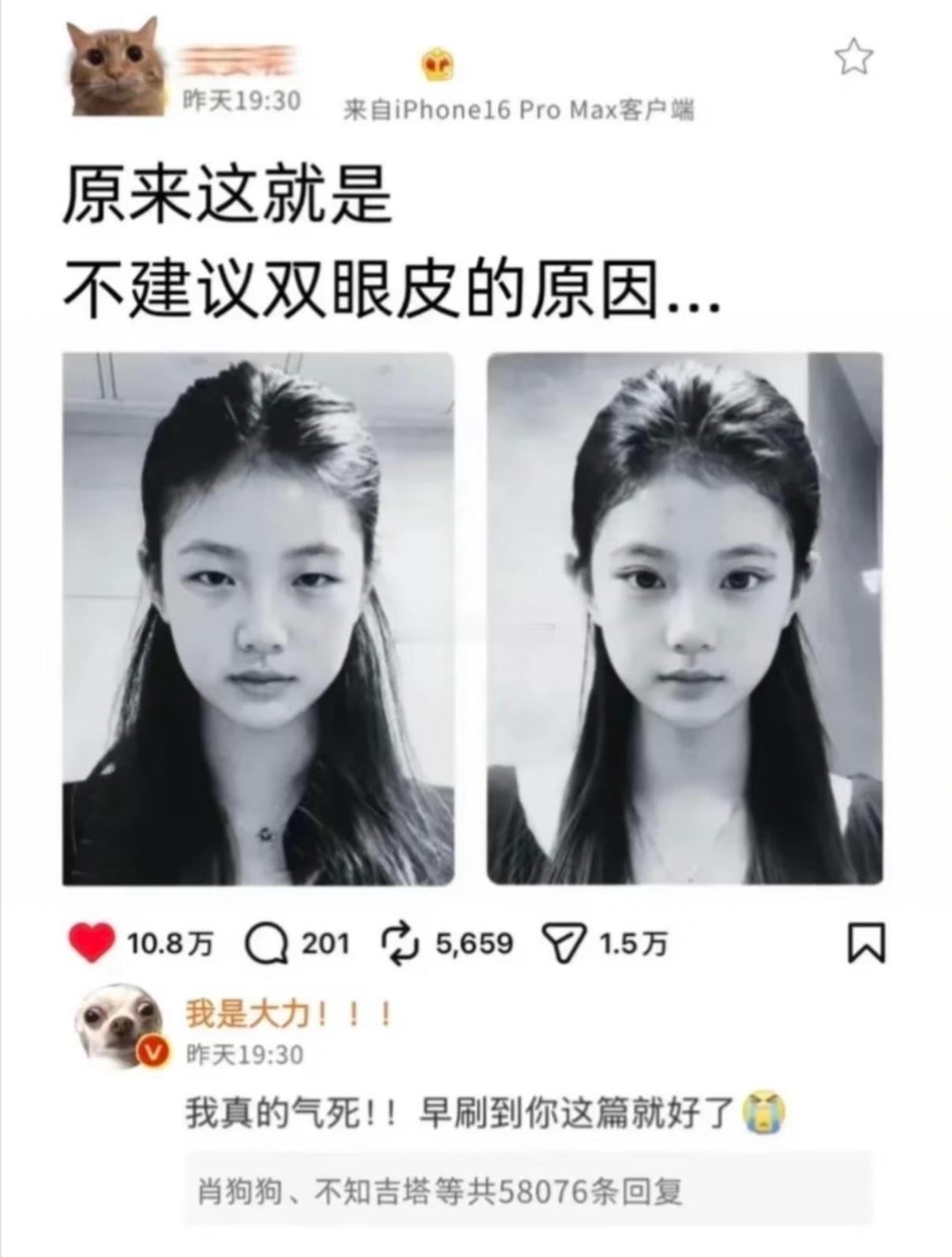 劝醒每一个冲动去割双眼皮的人！！！​​​