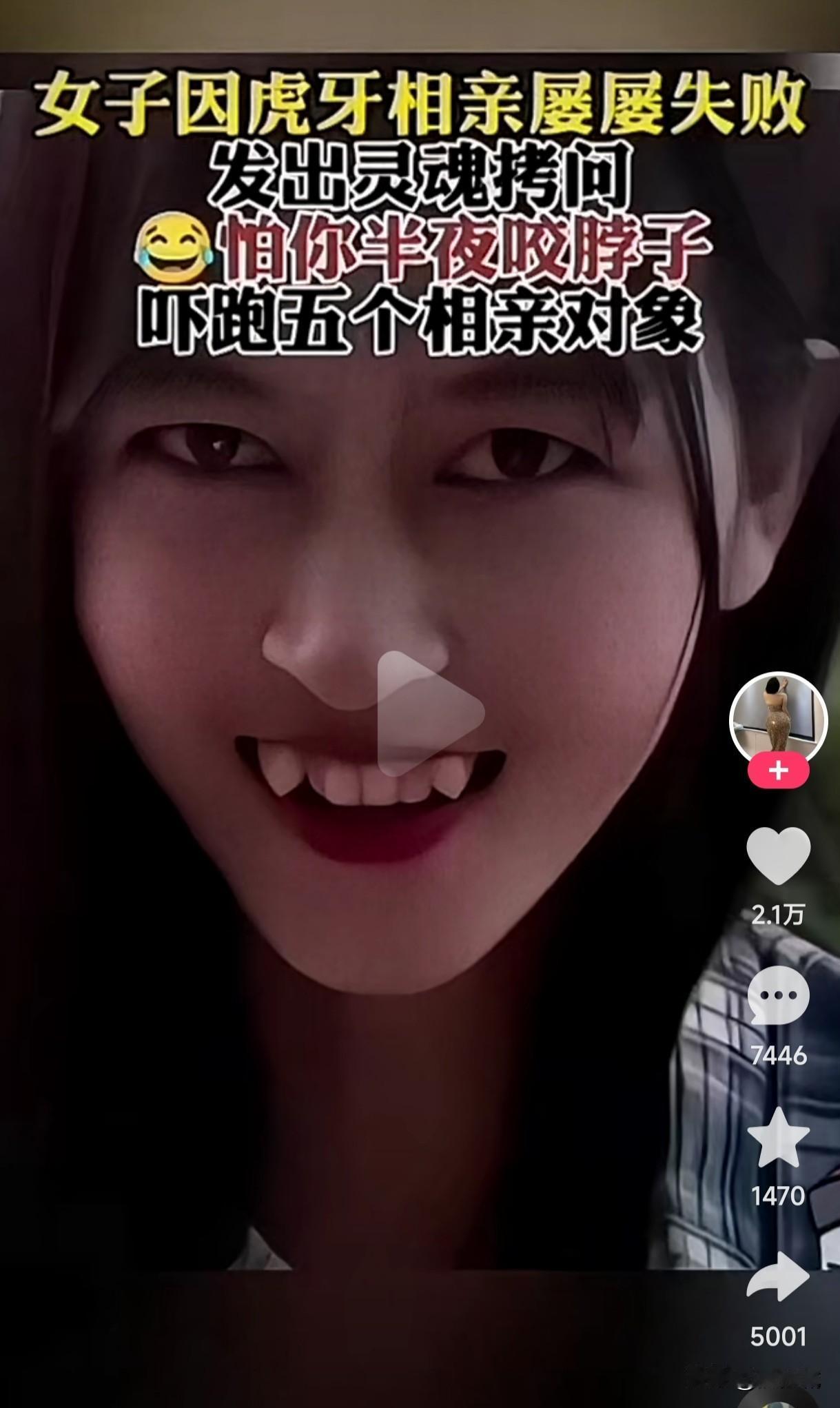 这种小虎牙不是有些男人的最爱吗？你看她的两个小虎是不是很可爱？女子因虎牙相亲