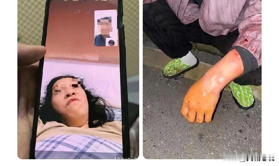 你赞成养狗吗？12月9日，湖南省株洲市天心区53岁喻女士吃过晚饭蹓狗时被突然窜