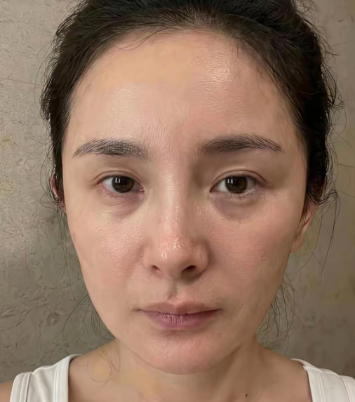 杨幂大方晒出自己的素颜照作为明星晒素颜照还是挺让人佩服的在娱乐圈这个处处充斥