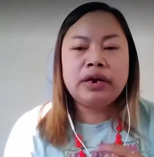 凤姐的门牙掉了，愣是没去补。不是不想，是不敢。在美国漂了十五年，她现在的