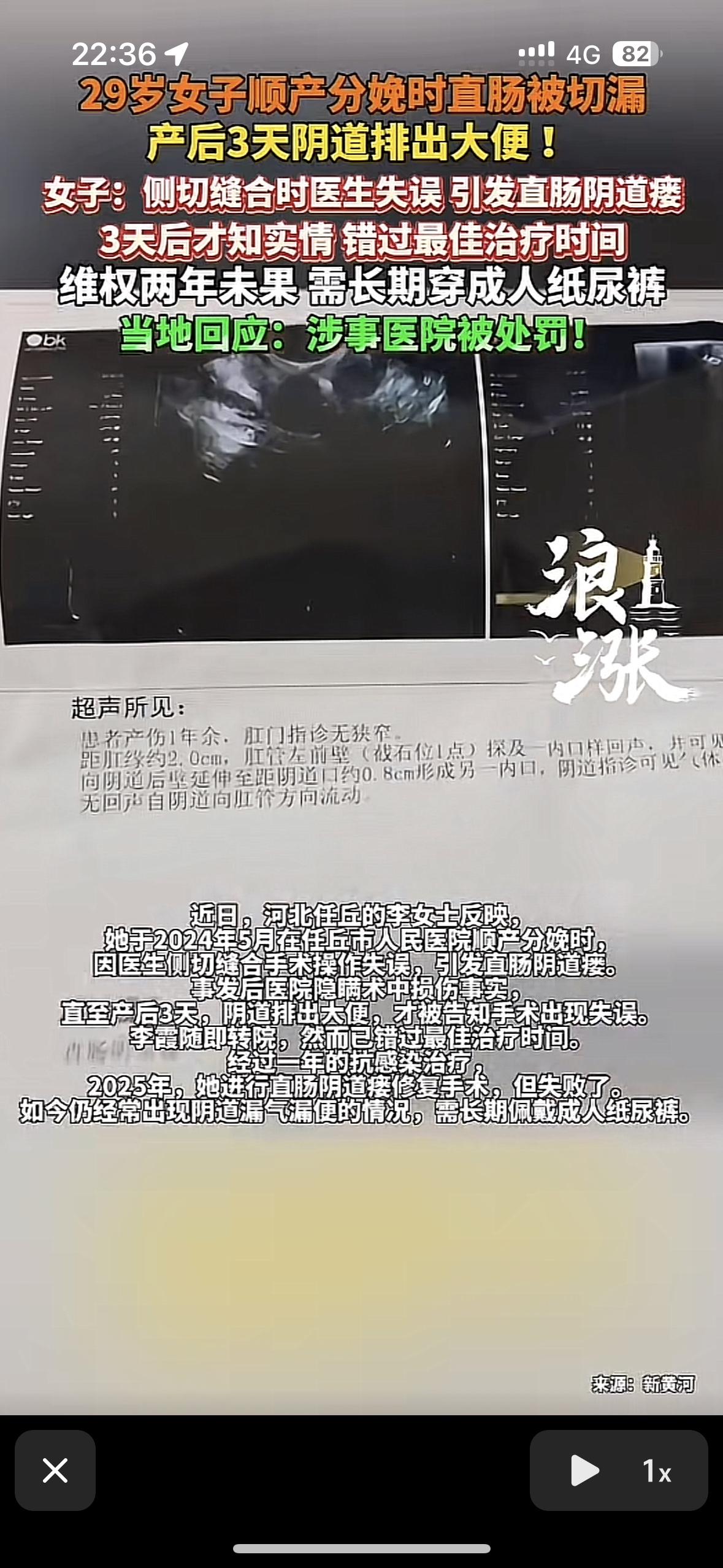 太可恶了！29岁的产妇在河北沧州任丘医院顺产，在医生侧切缝合时一针捅穿了她的大肠
