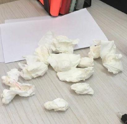 鼻科温顺明: 大蒜治鼻炎, 一治一个准, 太管用了, 后悔现在才知道!