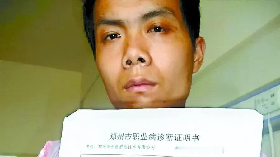2009年，河南农民工张海超为了证明自己得了尘肺病，他硬生生让医生切开胸膛，取出