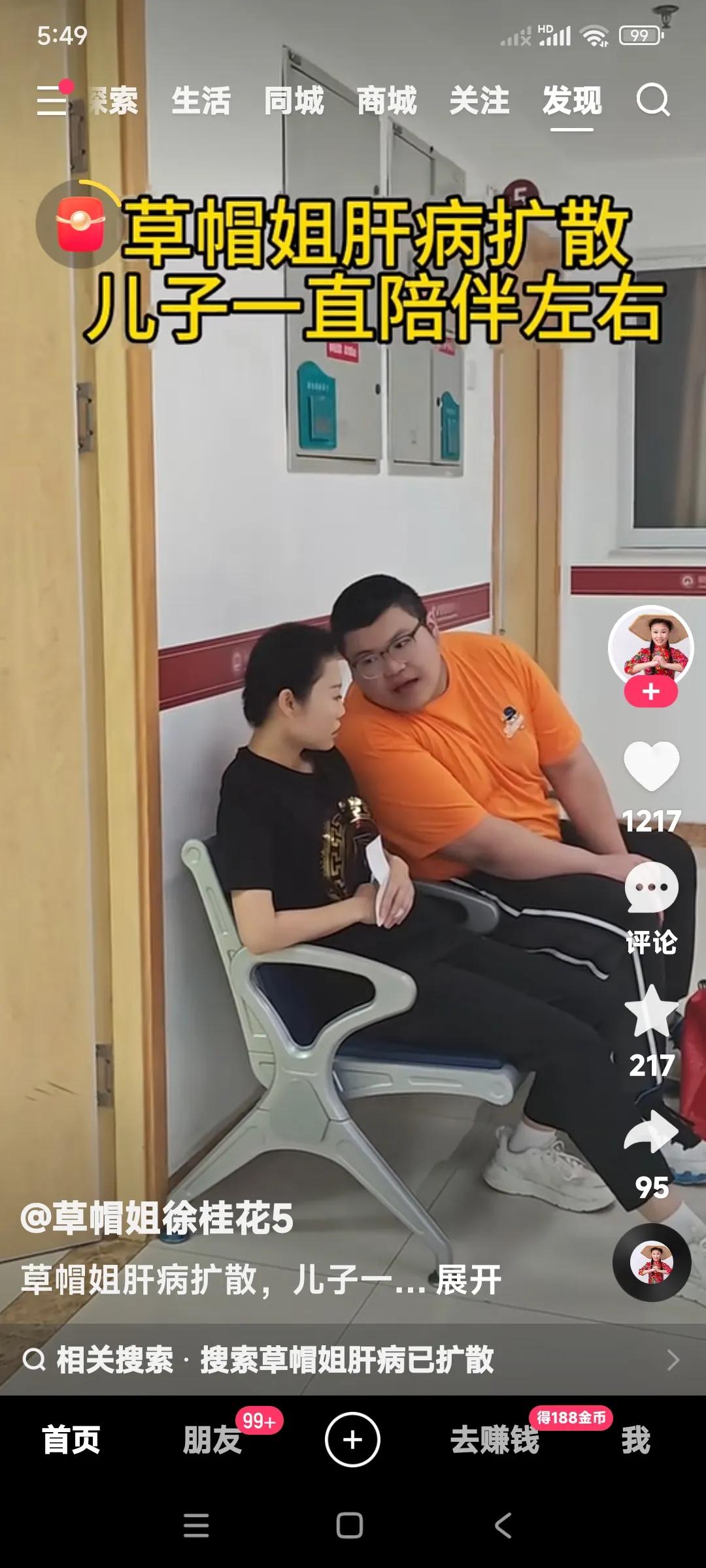 草帽姐得了肝病，有儿子在身边陪。只要有儿子在身边陪伴，就有了治愈疾病的底气。