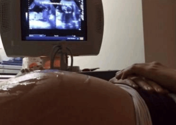 孕妈被熊孩子撞成了早产, 熊孩子父母却说出这样的话, 医生听完都觉得尴尬