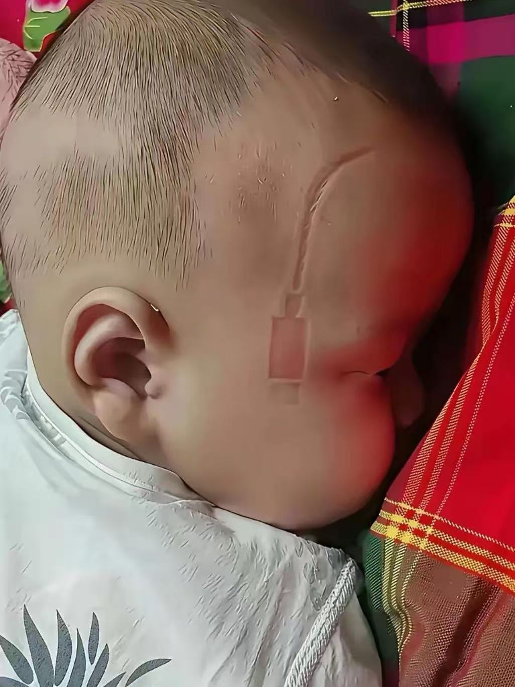 还有这样的胎记，真是无奇不有