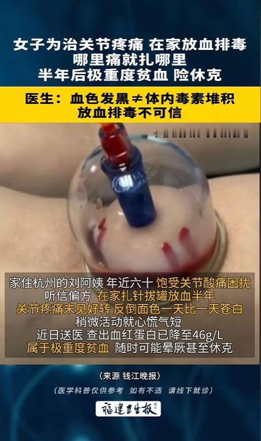 “偏方不能轻信！”8月20日报道，浙江杭州，一女子饱受关节酸痛多年，她没去正规医