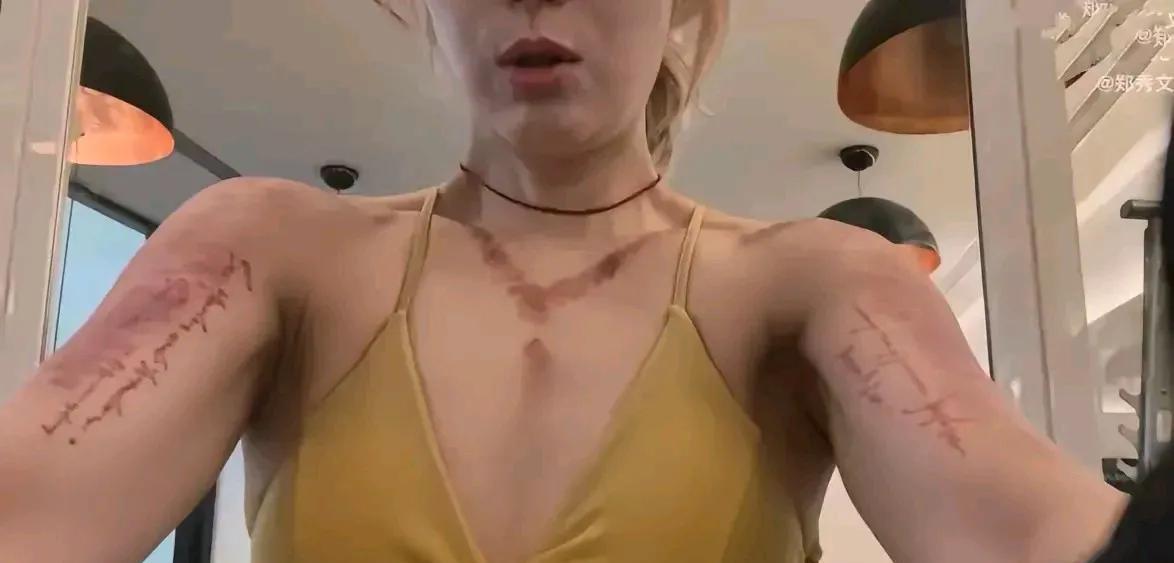 真不知道郑秀文咋想的，对健身好像到了痴迷的地步，刚刮完痧就来健身，这样对身体一点