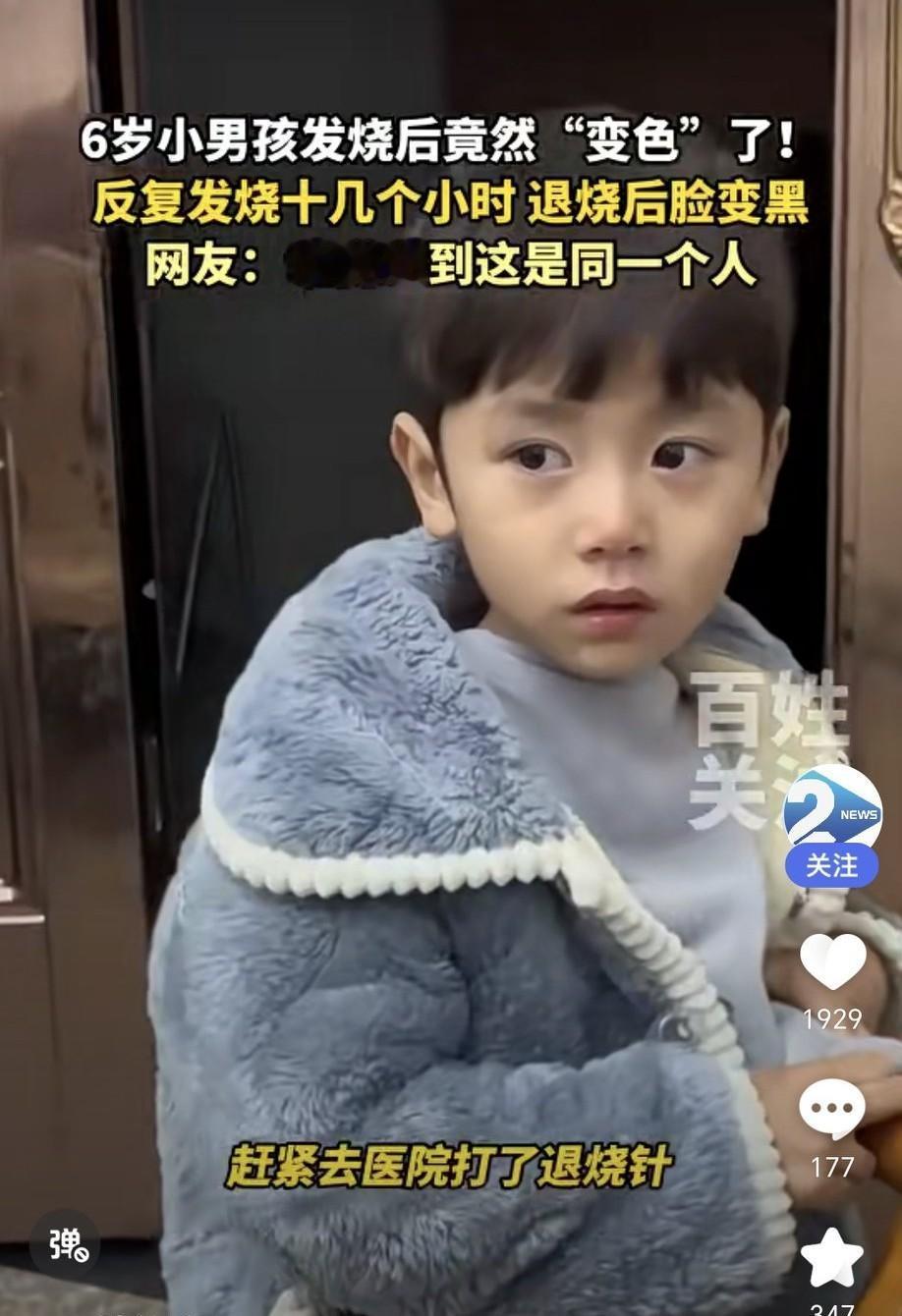 湖南衡阳6岁小男孩，高烧40度烧了十几个小时，退烧后脸竟变黑，把妈妈陆女士吓坏了