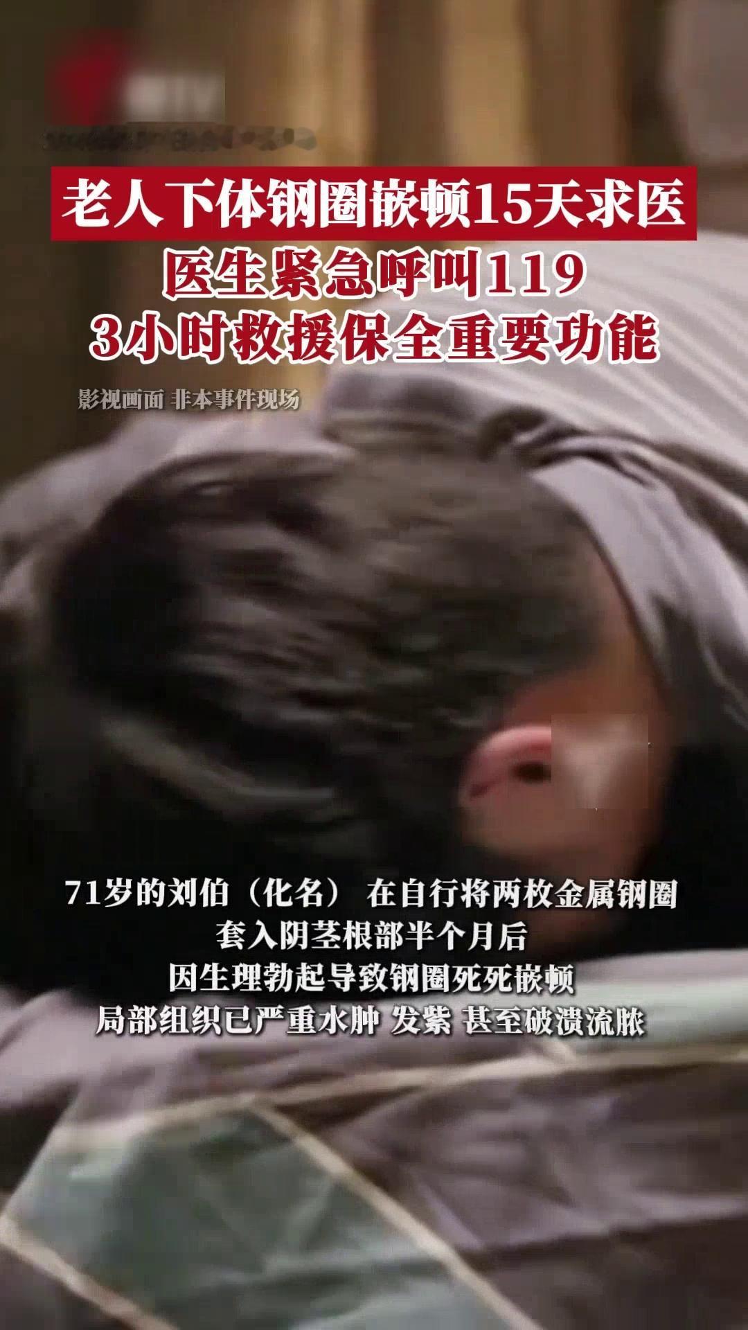 男人至死是少年，71岁大爷把钢圈套入下体近日，广州一位71岁大爷尝试奇葩偏方
