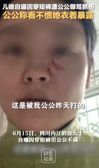 四川内江，一女子在家穿短裤消暑，竟遭公公当着她9岁儿子的面辱骂“伤风败俗”“不要