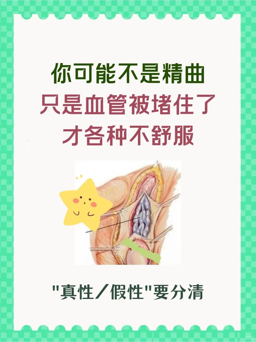 精索静脉曲张，“真性/假性”要分清精索静脉曲张还分真假吗？精索静脉