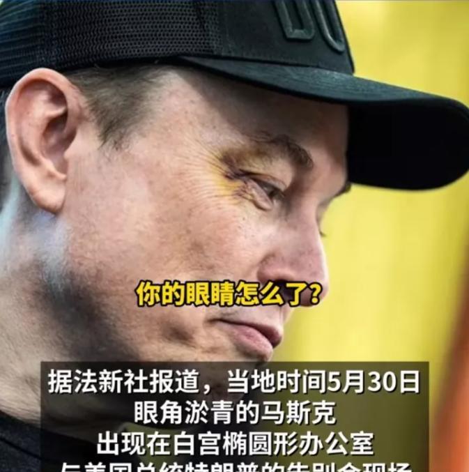 有时候还真是需要耐心，让子弹飞一会儿！5月30日，马斯克眼角淤青被记者发现，当时