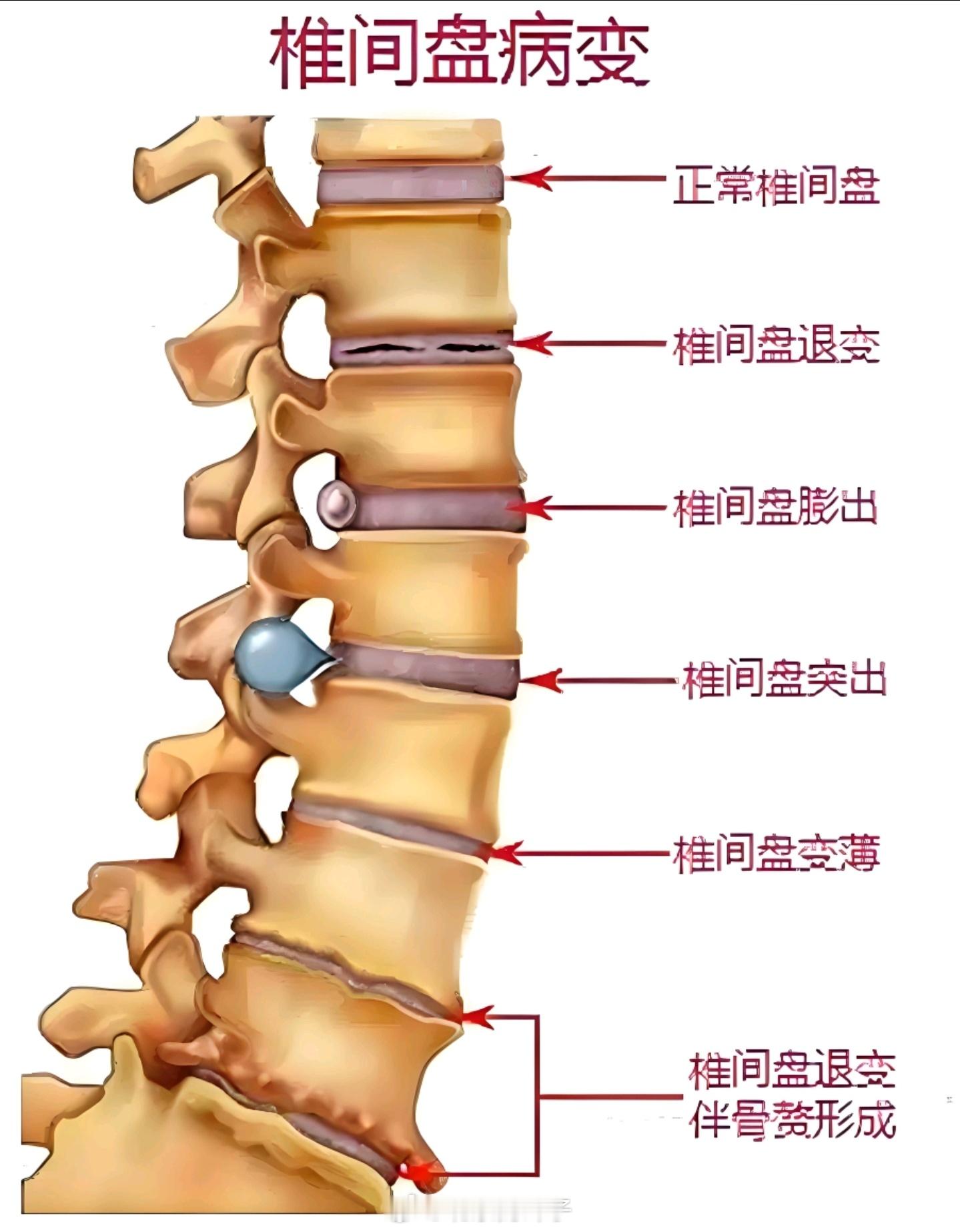 现在已经没人开腰疼的玩笑了因为大家都开始真的腰疼了，还有脖子疼，谁疼谁知道