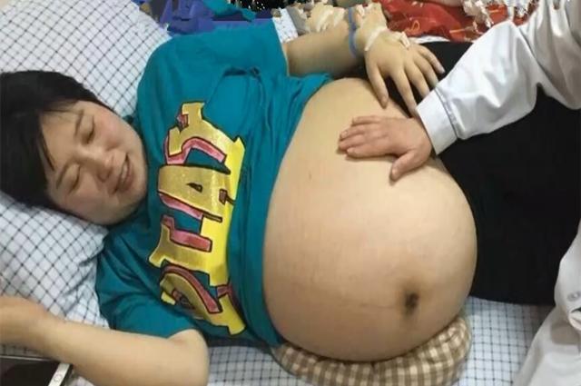 孕七月四胞胎提前发动, 看到宝宝性别后, 整个妇产科沸腾了