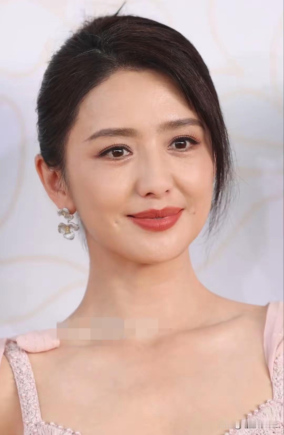 面部填充后的丫丫大变样，脸蛋看起来饱满紧致，整个人一下子年轻起来，与之前干