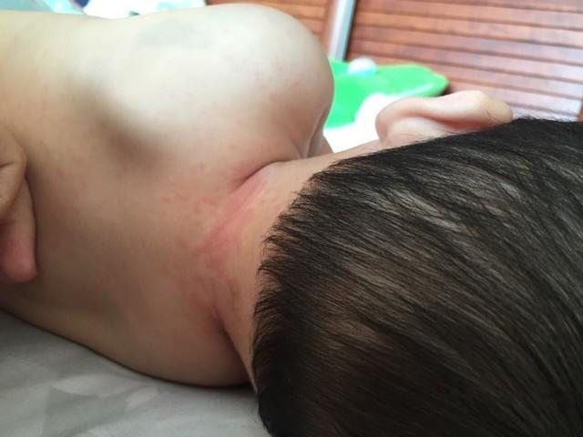 宝宝反复发烧, 是因为很多家长都分不清的这个原因