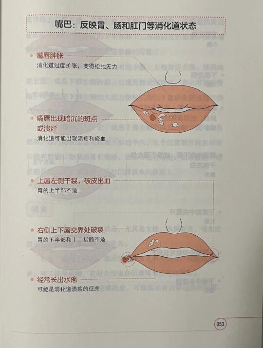 中医：看嘴识病