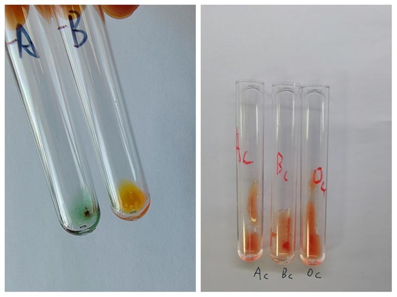 【超罕见！南通惊现“恐龙血”献血者】😲近日，南通血站有重大发现！在常规血筛时，
