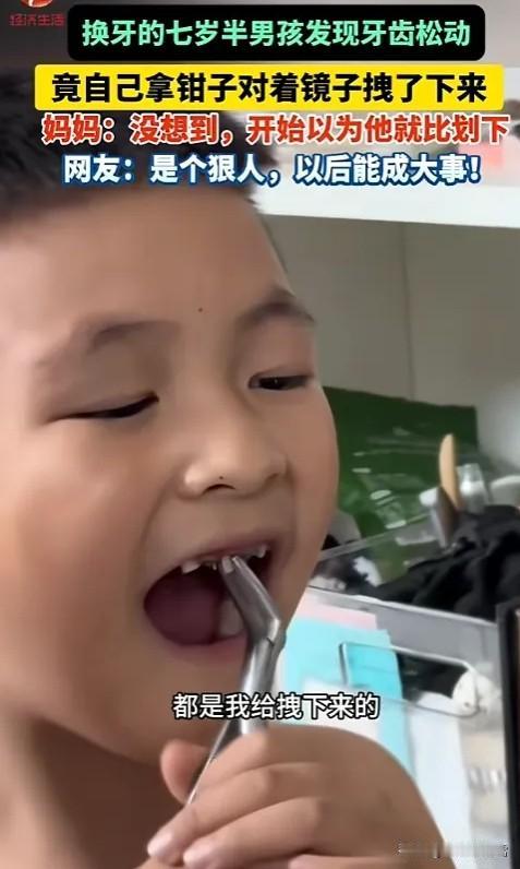 “此子必成大器！”6月9日报道，黑龙江，一个七岁半的男孩正在换牙期，发现自己有颗