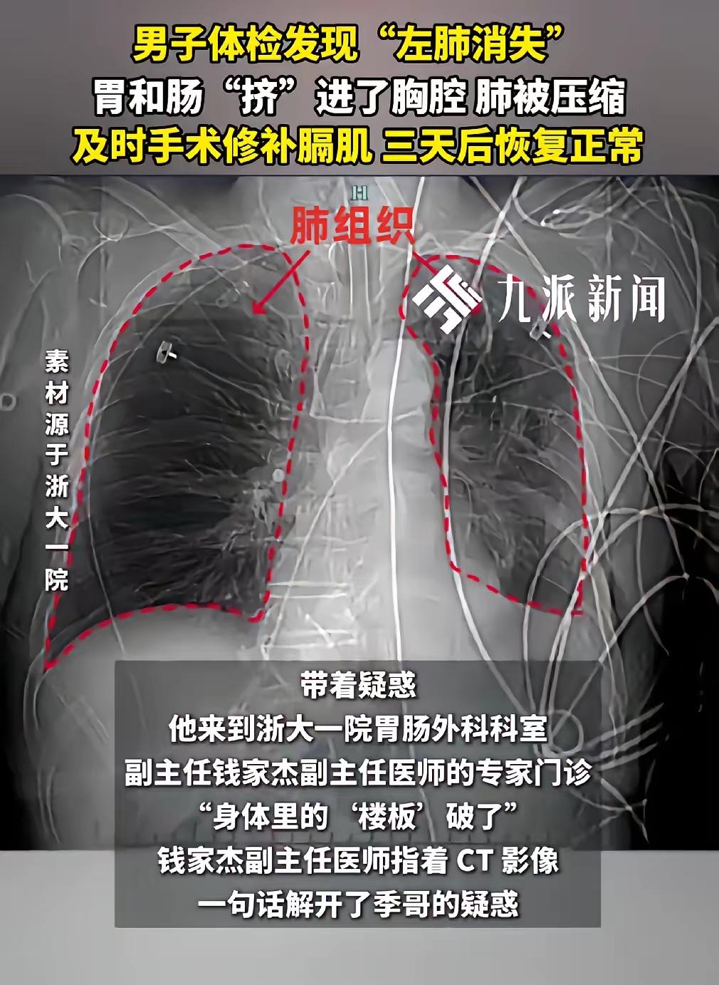 “这就是命！”浙江，一男子参加活动抽奖，意外中奖获得了一次免费体检的资格，可体检