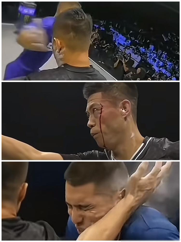 都说赵鸿刚不抗打？他可太抗打了！扇巴掌大赛，70公斤对手打完他手臂骨折，