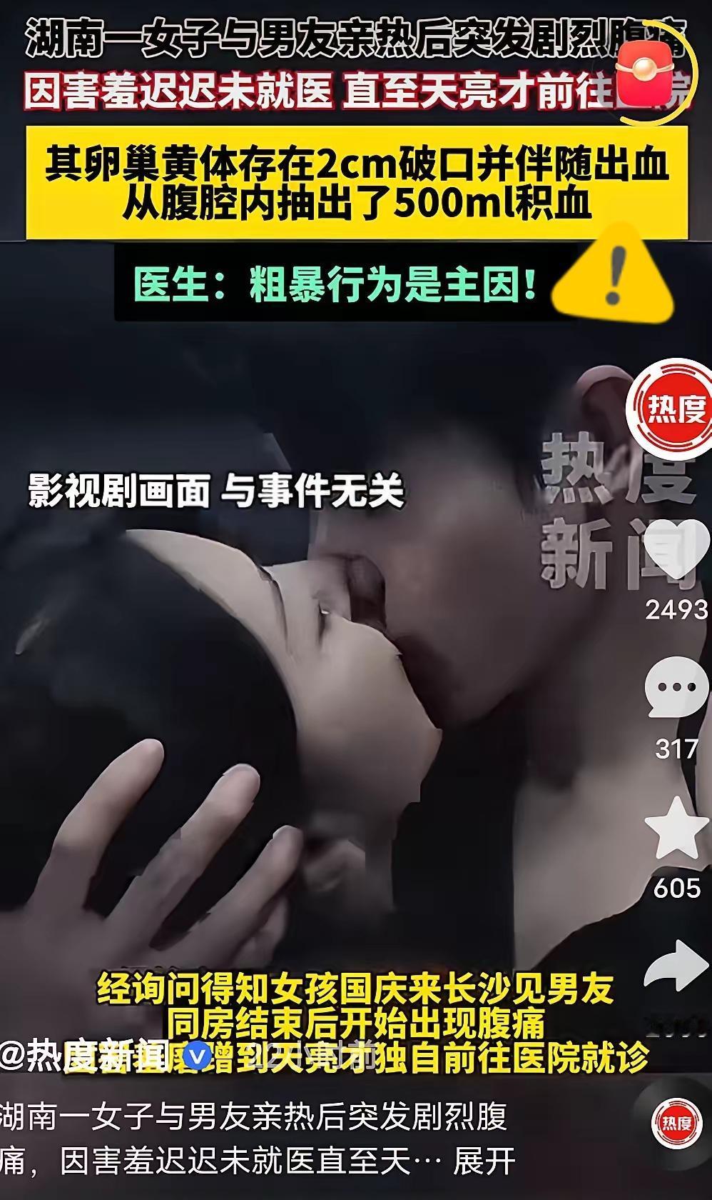 这也太猛了！湖南，一女孩儿因为肚子突然急剧疼痛，前去就医。谁知，医生检查完后，竟