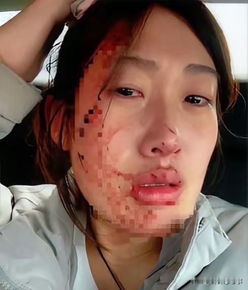 我也是个孩子，为什么要这样对我？6岁女孩那天去医院输液，因为害怕一直动，针扎