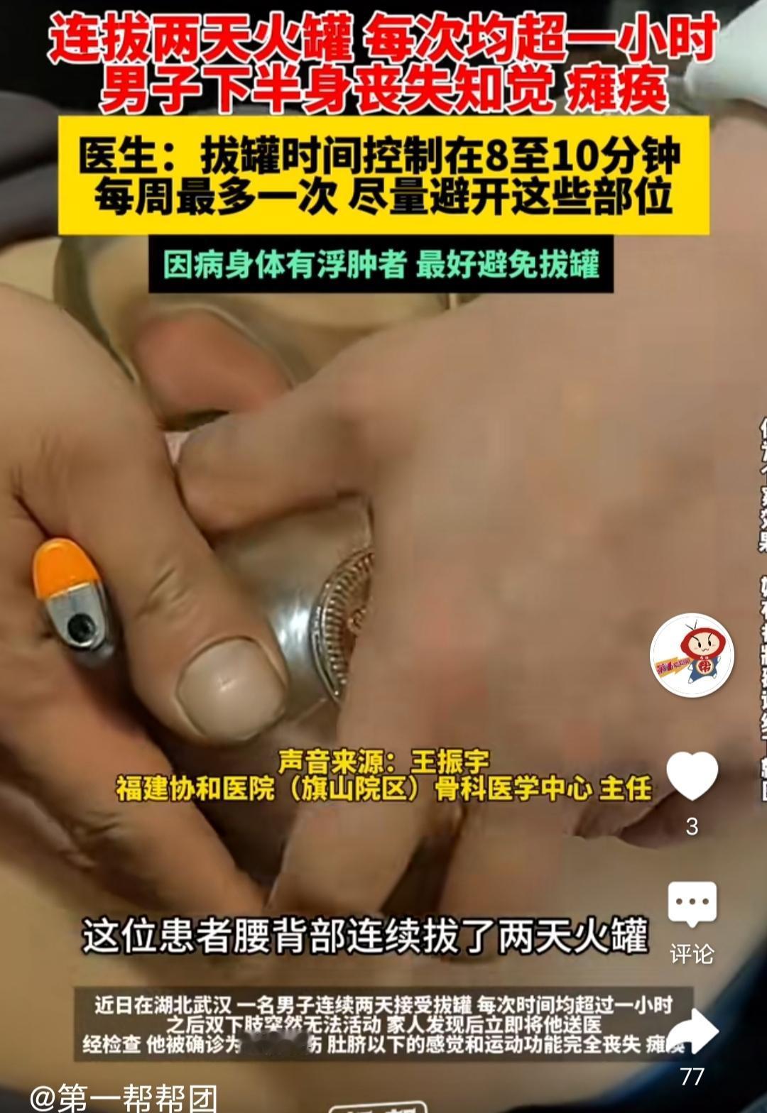 连拔两天火罐，每次均超一小时，男子下半身丧失知觉。相关媒体的报道，湖北武汉的