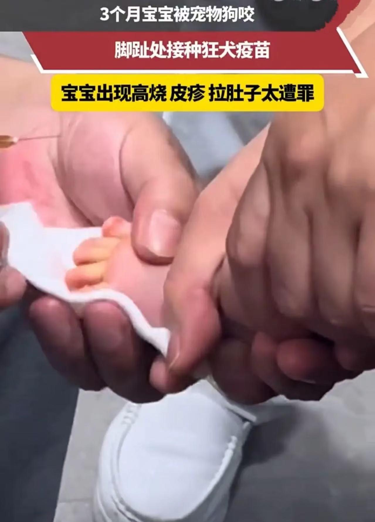 “这次养狗的后悔了！”就因为家里养的狗“吃醋”，才三个月大的宝宝，硬生生遭了半条