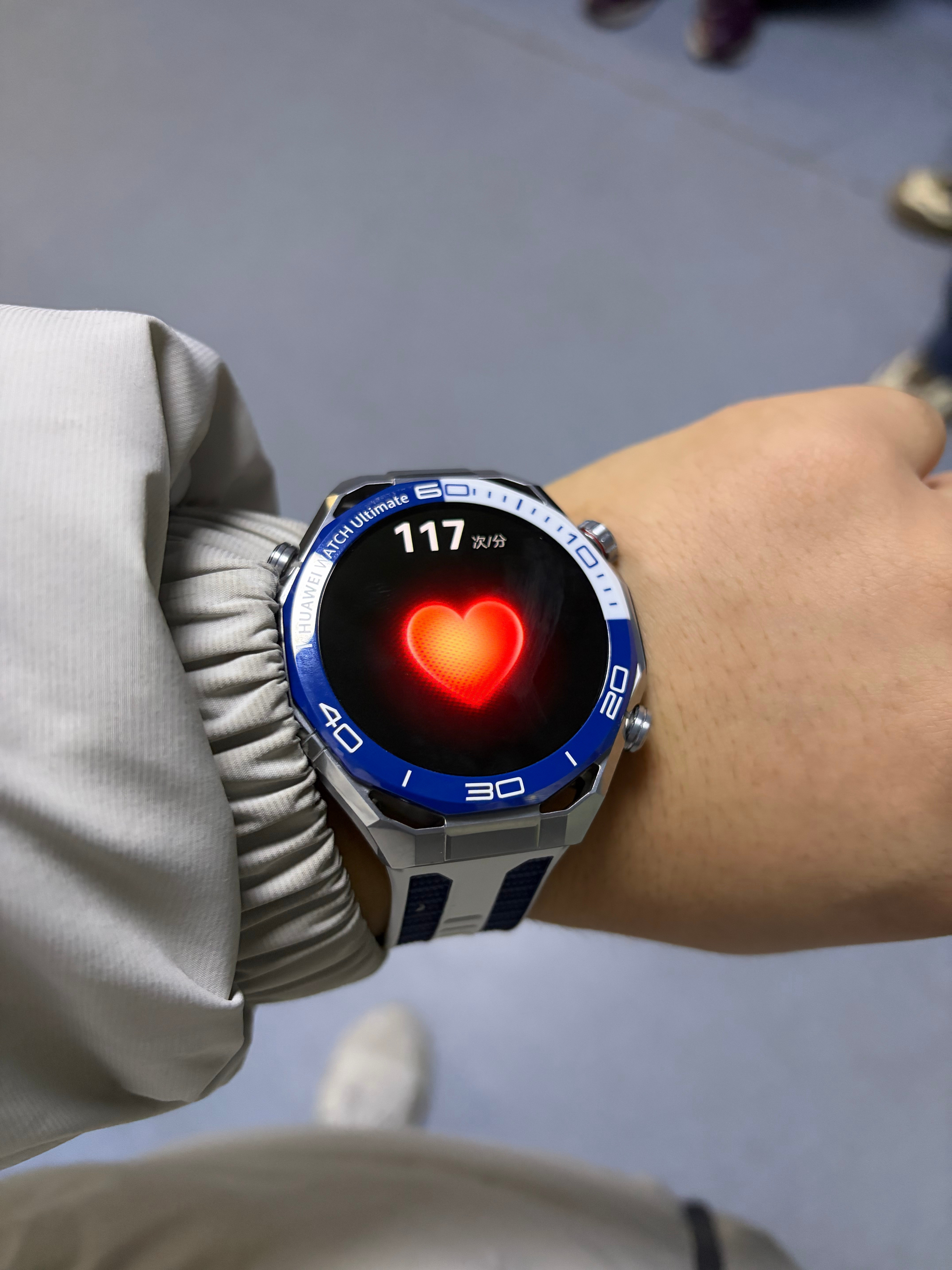 第一次做核磁还有点紧张据说这玩意声音老大了。