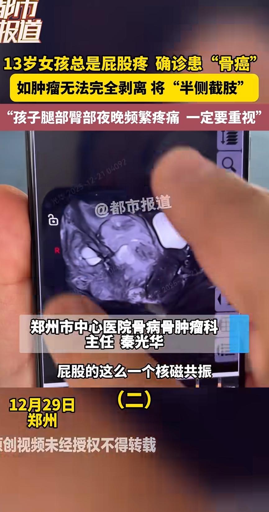 最近，一个让人揪心的消息上了热搜：湖南一名13岁女孩因为频繁屁股疼，去医院检查后