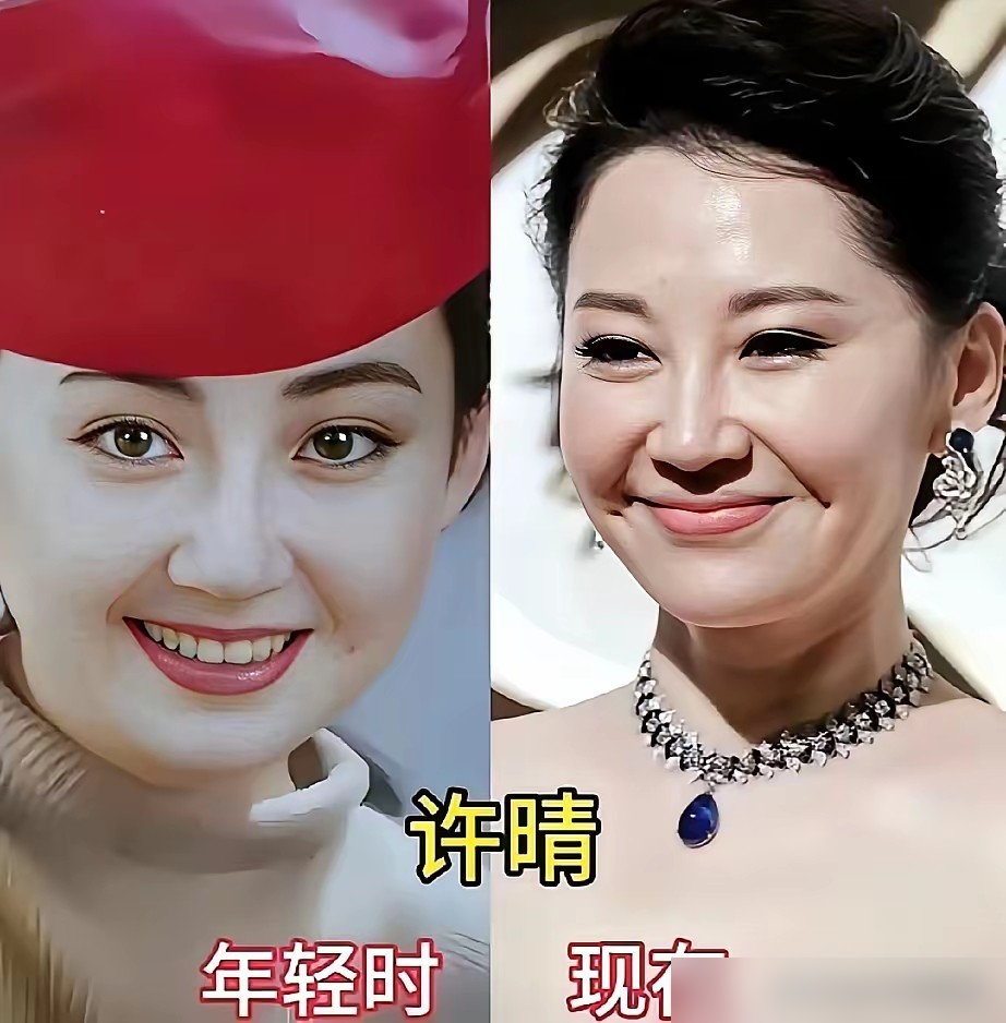 56岁的许晴被人在机场堵住了，素颜，丸子头，一件宽大的白褂子罩着，脚踩双玫红平底鞋。镜头怼脸拍，小腹