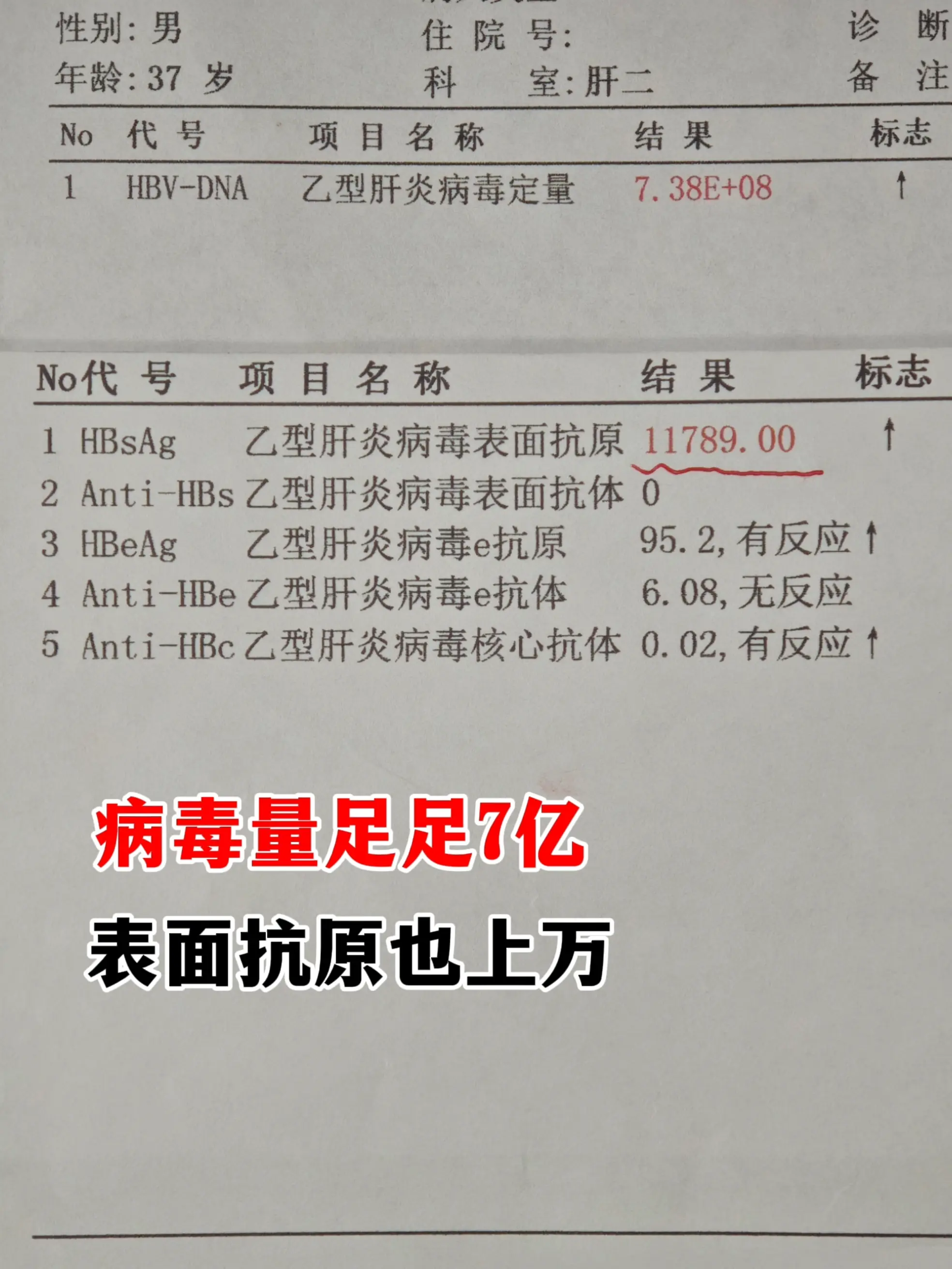 你见过这么高的病毒量吗？这也是我今年见过最高的一个了！并且，他的表面抗...