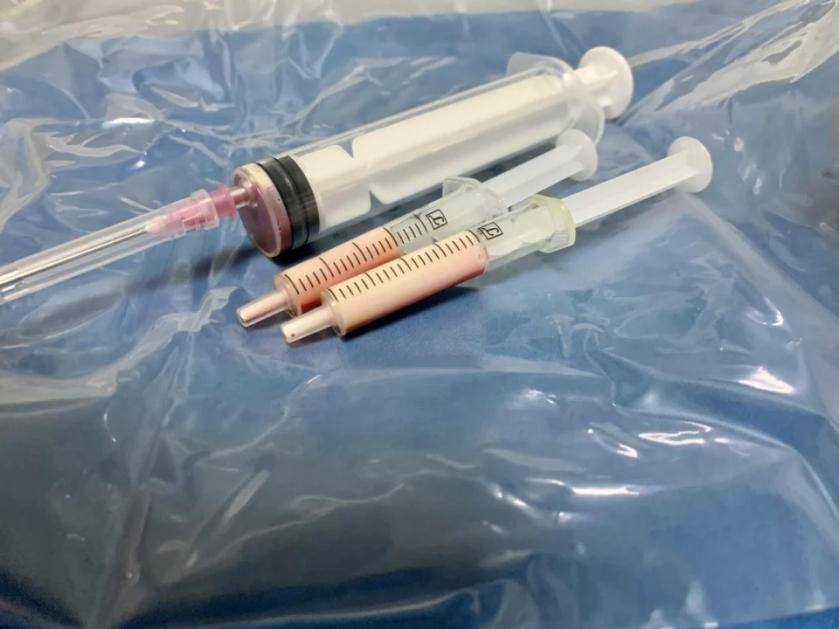 血脂高别硬扛！46岁大哥突发胰腺炎，医生抽血——管子里的血白得像牛奶！46岁