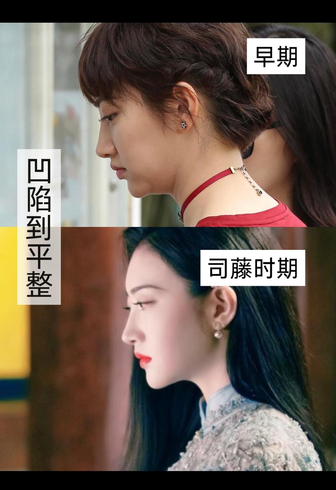 不知道她是瘦了，还是整过了！反正看着比以前好看多了，尤其是她的下巴！感觉跟之