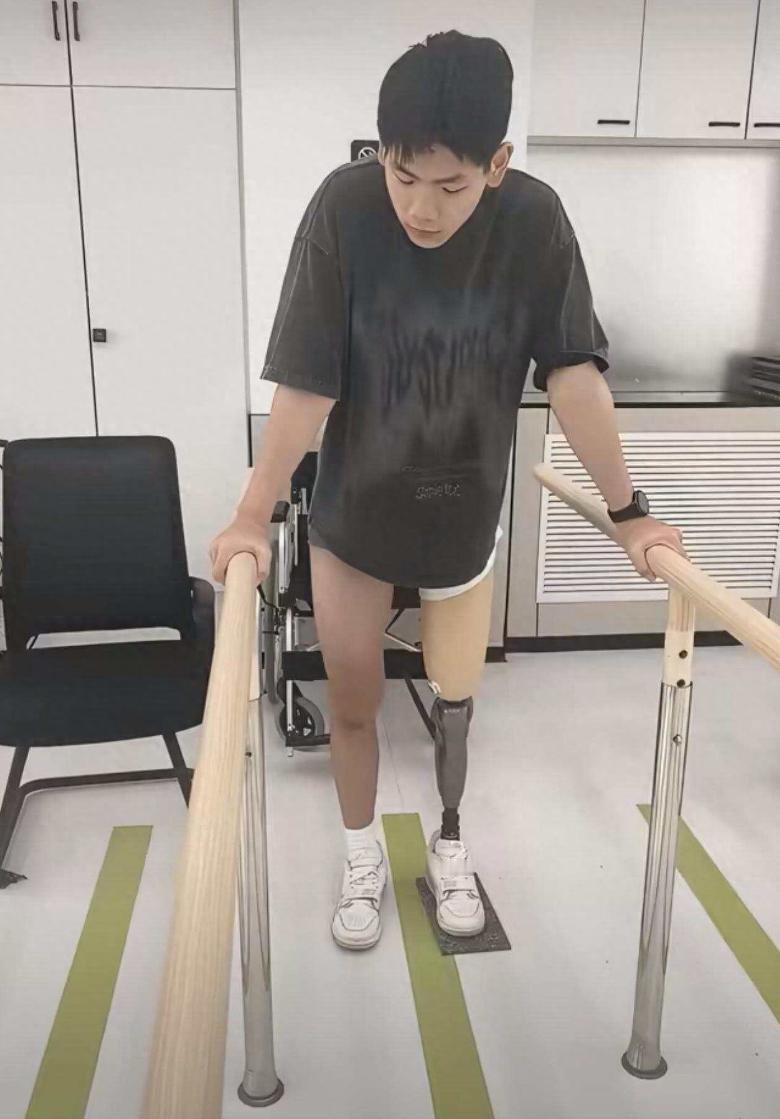 19岁的速滑运动员王新睿，截肢后首次露面，6次重大手术抢救，还是没能留住他的腿。